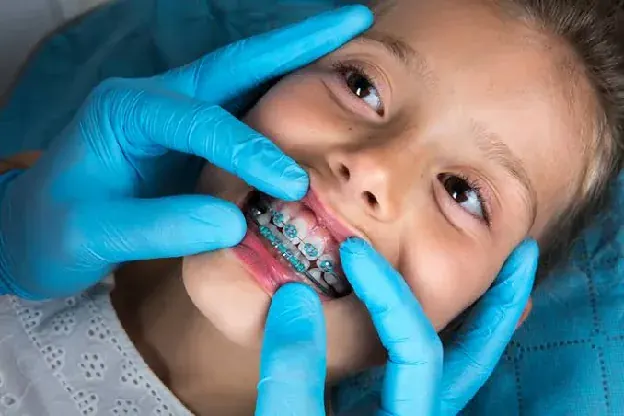 A child during active fixed appliance treatment